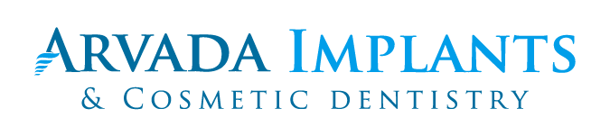 Smile Vision | Arvada Implants & Cosmetic Dentistry